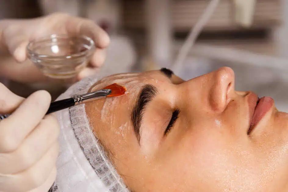 How Chemical Peels Can Transform Your Skin: A Complete Guide