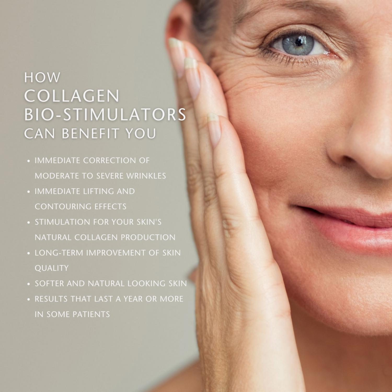 Collagen Biostimulators, the Hollywood Trend at Joslin Medical Spa